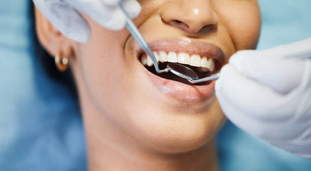 Best Emergency Treatment for Dental Infections or Abscesses in Balm, FL